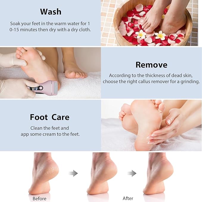 Electric Callus Remover for Feet, Rechargeable Portable Electronic Foot Callus Remover 2-in-1 Wet/Dry Foot Scrubber Electric Toot File for Hard Cracked Dry Dead Skin(Pink)