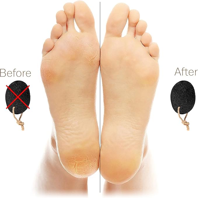 Pumice Stones for Feet - Natural Earth Lava Black Pack of 2 - Callus/Corn Remover for Feet Heels and Palm - Pedicure Exfoliation Tool - Dry Dead Skin Scrubber - Health Foot Care