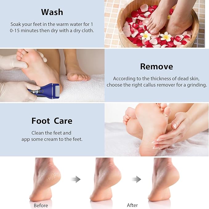 Electric Callus Remover for Feet, Rechargeable Portable Electronic Foot Callus Remover 2-in-1 Wet/Dry Foot Scrubber Electric Toot File for Hard Cracked Dry Dead Skin（Blue）