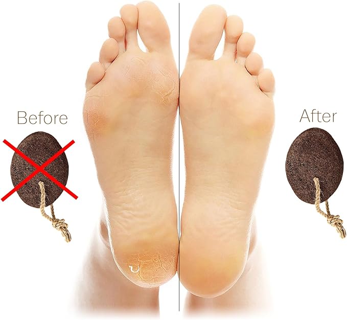 Pumice Stones for Feet - Natural Earth Lava Brown Pack of 2 - Callus Corn Remover for Feet Heels and Palm - Pedicure Exfoliation Tool - Dry Dead Skin Scrubber - Health Foot Care