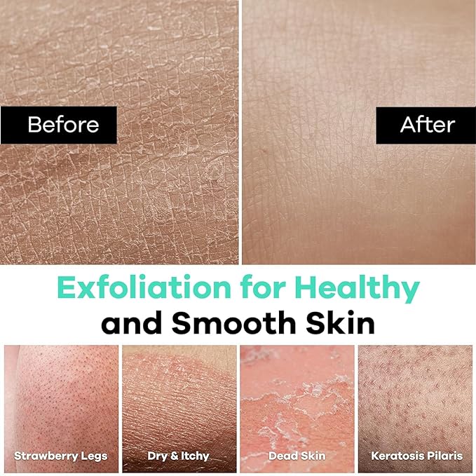 Dermasuri - Deep Exfoliating Glove - Korean Exfoliating Mitt - Body Scrubber for Shower - Buffs Dry & Dead Skin - Keratosis Pilaris Treatment Scrub - Stocking Stuffer Gifts for Women & Men - Teal Mitt