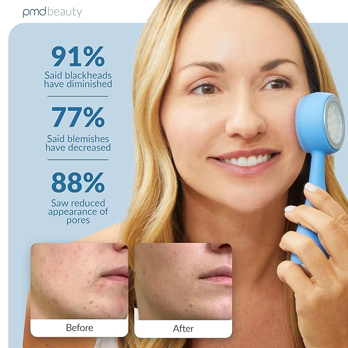 PMD Beauty Facial Cleansing Brush - Smart Silicone Brush with Blue Light Treatment - SonicGlow Vibration - Waterproof Device for Acne